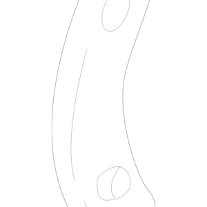 Axle Assembly Reinforcement - BMW (33-20-7-572-719)